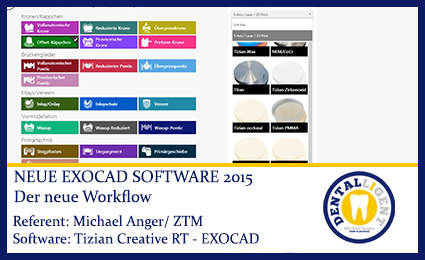 Product image of the product “2015-Der neue Workflow - EXOCAD ”
