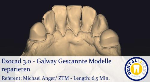 Product image of the product “2021-Exocad 3.0 –  Galway Gescannte Modelle reparieren ”