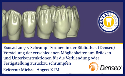 Product image of the product “2017-NEW EXOCAD TUTORIAL DENSEO - 7 Schrumpf-Formen in der Bibliothek (Denseo) ”