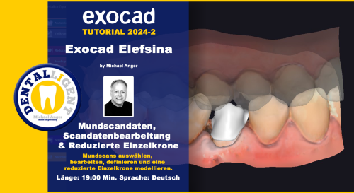 Product image of the product “Exocad Elefsina 2024-2 Mundscandaten & Scandatenbearbeitung & Reduzierte Einzelkrone ”