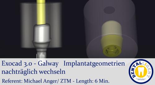 Product image of the product “2021-Exocad 3.0 – Galway  Implantatgeometrien nachträglich wechseln ”