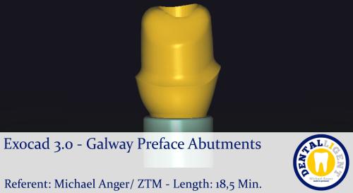 Product image of the product “2021-Exocad 3.0 – Galway   Preface-Abutments ”