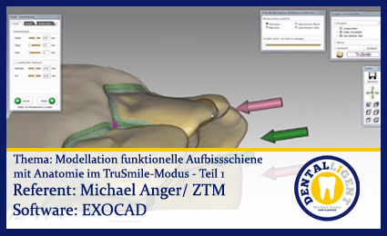 Product image of the product “Model. funkt. Aufbissschiene mit Anatomie im TruSmile-Modus - Teil 1 ”