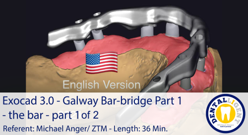 Product image of the product “2021-Exocad 3.0 – Galway Bar-bridge Part 1 - the bar - part 1 of 2 ”