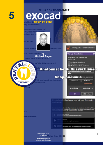 Product image of the product “Exocad Step by Step Anleitung -Nr. 5 - Anatomische Aufbissschienen & Snap-on-Smile ”