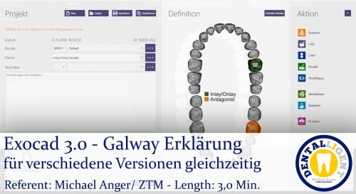 Product image of the product “2021-Exocad 3.0 - Galway Erklärung für verschiedene Versionen gleichzeitig ”