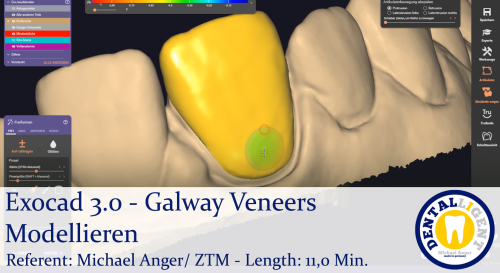 Product image of the product “2021-Exocad 3.0 – Galway Veneers Modellieren ”