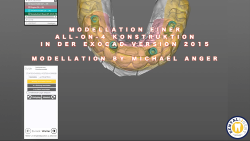 Product image of the product “GRATIS - Modellation einer All-On-4 Konstruktion aus CoCr ”