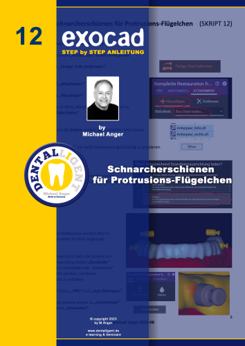 Product image of the product “Exocad Step by Step Anleitung - Nr. 12 - Schnarcherschienen für Protrusions-Flügelchen ”