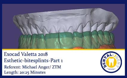 Product image of the product “2018-Exocad-Valetta-esthetic-bitesplints-Part1 ”