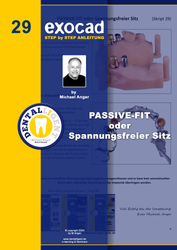 Product image of the product “Exocad Step by Step Anleitung - Nr. 29 PASSIVE-FIT oder Spannungsfreier Sitz ”