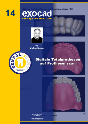 Product image of the product “Exocad Step by Step Anleitung - Nr. 14 Digitale Totalprothesen auf Prothesenscan ”