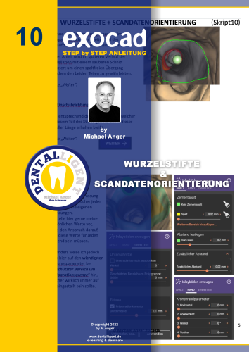 Product image of the product “Exocad Step by Step Anleitung - Nr. 10 - Wurzelstifte & Scandatenorientierung ”
