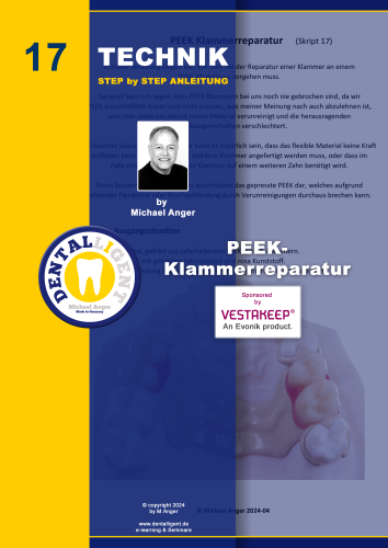 Product image of the product “Technik Step by Step Anleitung - Nr. 17 PEEK-Klammerreparatur ”