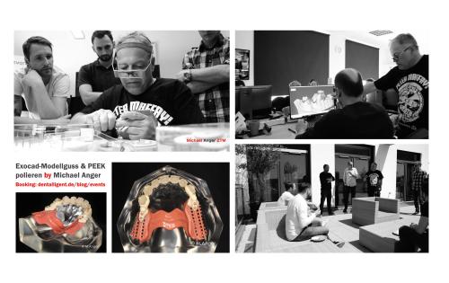 Product image of the product “Exocad-Modellguss & PEEK polieren by Michael Anger ”