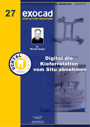 Product image of the product “Exocad Step by Step Anleitung - Nr. 24 Digital die Kieferrelation vom Situ abnehmen ”
