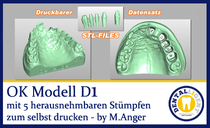 Product image of the product “OK-Model D1-STL-Files for self-print ”