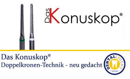Product image of the product “Das Konuskop® - Doppelkronentechnik ”