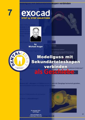 Product image of the product “Exocad Step by Step Anleitung -Nr. 7 -   Modellguss mit Sekundärteleskopen verbinden ”