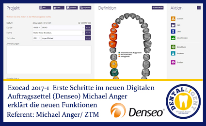 Product image of the product “2017-NEW EXOCAD TUTORIAL DENSEO 2017-1 -  Erste Schritte im neuen Digitalen Auftragszettel ”