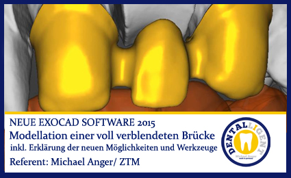 Product image of the product “Modellation einer vollverblendeten Brücke ”