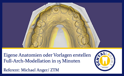 Product image of the product “2017-NEW EXOCAD TUTORIAL - Eigene Anatomien oder Vorlagen erstellen ”