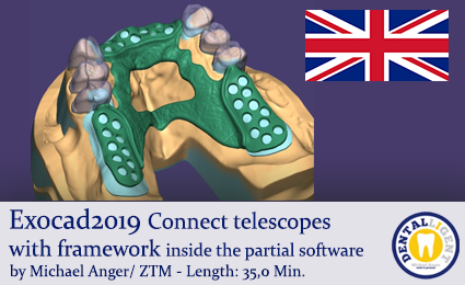 Product image of the product “Exocad2019  - Connect telescopes with framework inside the partial software ”