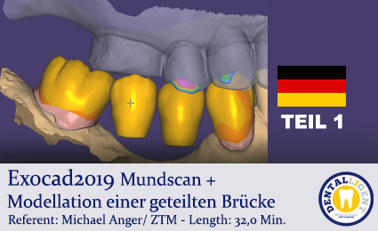 Product image of the product “Exocad2019  - TEIL 1 - Mundscan + Modellation einer geteilten Brücke ”