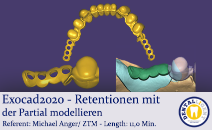 Product image of the product “2020-Exocad - Exocad-Plovdiv – Retentionen mit der Partial modellieren ”