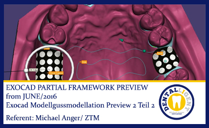 Product image of the product “2016-EXOCAD -Exocad Modellgussmodellation Preview 2 Teil 2 ”