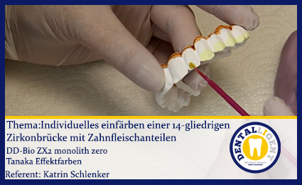 Product image of the product “Individuelles einfärben einer 14-gliedrigen Zirkonbrücke mit Zahnfleischanteilen ”