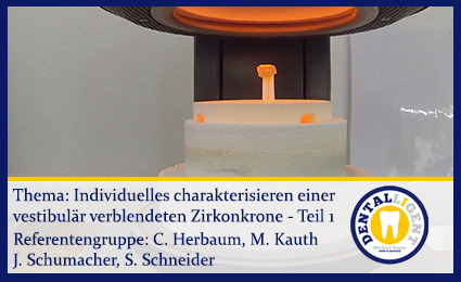 Product image of the product “Individuelles charakterisieren einer vestibulär verblendeten Zirkonkrone Teil 1 ”