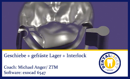 Product image of the product “2017-exocad 6547 