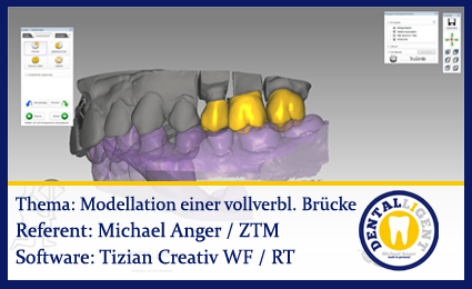 Product image of the product “Einführung Modellation einer vollverblendeten Brücke ”