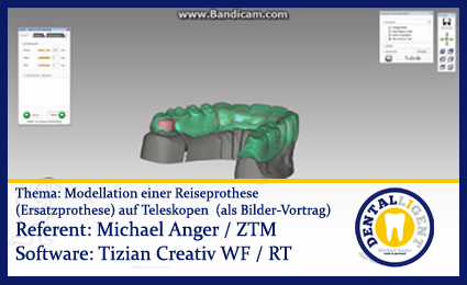 Product image of the product “Modellation einer Reiseprothese (Ersatzprothese) auf Teleskopen  (als Bilder-Vortrag) ”