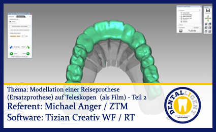 Product image of the product “Modellation einer Reiseprothese (Ersatzprothese) auf Teleskopen  (als Film) Teil - 2 ”