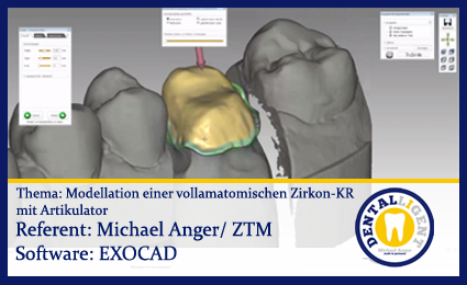 Product image of the product “Modellation einer vollamatomischen Zirkon-KR mit Artikulator ”