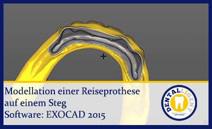 Product image of the product “2015-Modellation einer Reiseprothese auf einem Steg ”