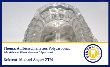 Product image of the product “GRATIS - Aufbissschiene aus Polycarbonat ”