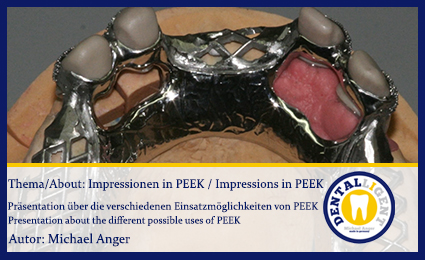 Product image of the product “GRATIS-Impressionen in PEEK / Impressions in PEEK ”