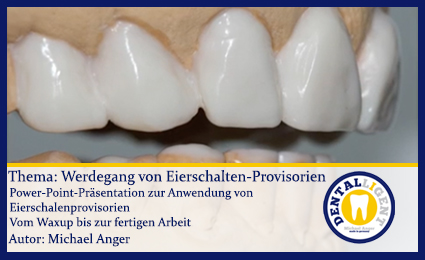 Product image of the product “GRATIS - Thema: Werdegang von Eierschalen-Provisorien ”