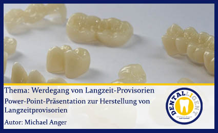 Product image of the product “GRATIS - Thema: Werdegang von Langzeit-Provisorien ”