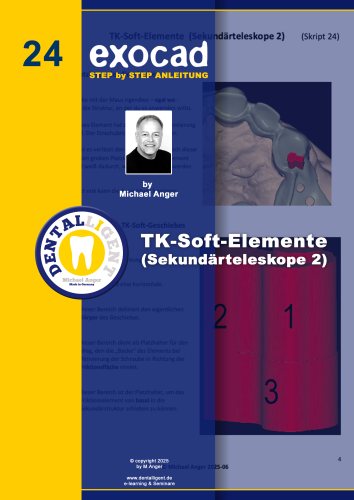 Product image of the product “Exocad Step by Step Anleitung - Nr. 24 TK-Soft-Elemente (Sekundärteleskope 2) ”