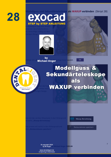 Product image of the product “Exocad Step by Step Anleitung - Nr. 28 Modellguss &  Sekundärteleskope  als  WAXUP verbinden ”