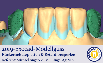 Product image of the product “2019 - Exocad-Modellguss Rückenschutzplatten & Retentionsperlen ”