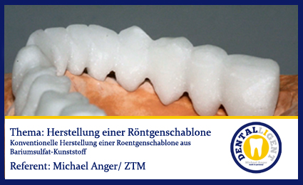 Product image of the product “GRATIS - Herstellung einer Roentgenschablone ”