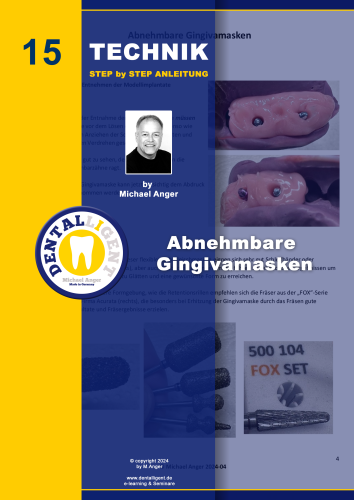 Product image of the product “Technik Step by Step Anleitung - Nr. 15 Abnehmbare Gingivamasken ”