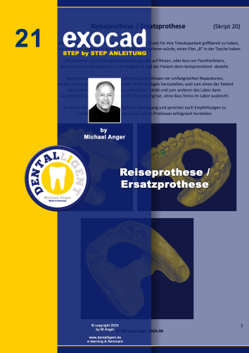 Product image of the product “Exocad Step by Step Anleitung - Nr. 21 Reiseprothese / Ersatzprothese ”
