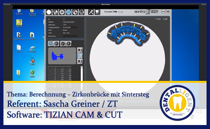 Product image of the product “Berechnnung – Zirkonbrücke mit Sintersteg ”