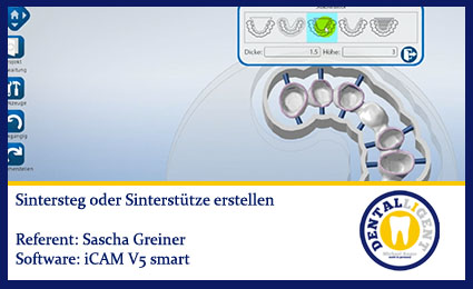 Product image of the product “iCAM V5 smart- Sintersteg erstellen ”